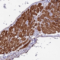Eco1 Antibody, Novus Biologicals 0.1mL; Unlabeled:Antibodies, Polyclonal